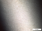 Metalle